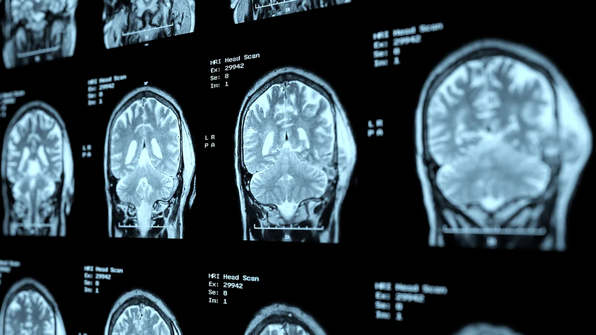 Images d&rsquo;IRM du cerveau